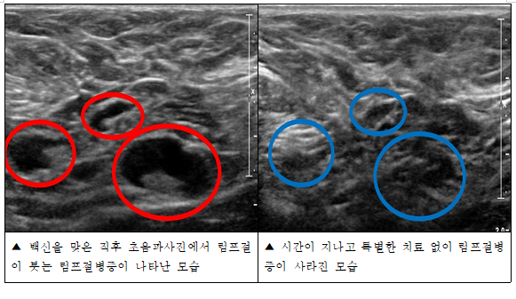 (자료제공=한림대동탄성심병원)