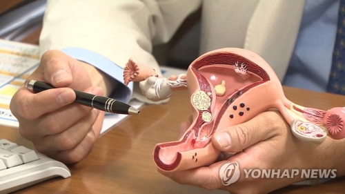 '여성의 감기' 질염, 여름철 발병률↑…증상에 맞게 약 써야