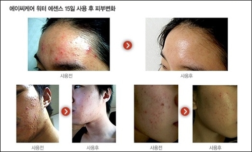 사진설명